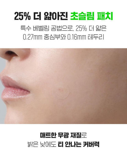 [FATION] NoscA9 Ultra-Thin Spot Patch Set with Natural Matte Finish (102 Patches)