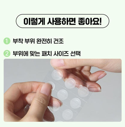 [FATION] NoscA9 Ultra-Thin Spot Patch Set with Natural Matte Finish (102 Patches)