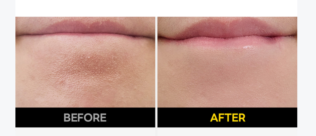 [MEDIHEAL] Vitamin C Brightening Serum with Niacinamide | Tone · Texture · Glow Care | 40ml x2 Double Set | GlowLab