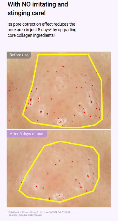 [BIOHEAL BOH] Probioderm Collagen Remodeling Serum – Silky, Radiant Finish | 30mL