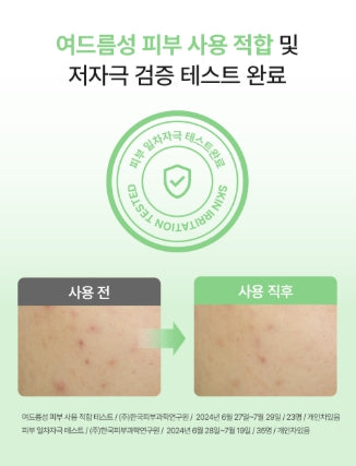 [ongredients] AC Balancing Hydrating Hydrogel Spot Patch Set · Clear Comfort Finish · 9 Patches