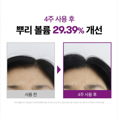 [VT] Reedle Shot Hair Boosting Ampoule Lightweight Scalp Care 100ml | Single or Double Set