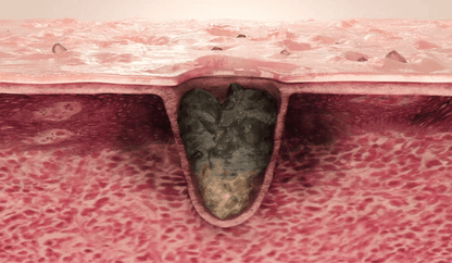 [Medicube] Zero Pore Pad 2.0 Refill Set | Daily Skin Care & Sebum Control | 70 Pads