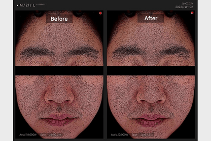 [Medicube] Zero Pore Pad 2.0 Refill Set | Daily Skin Care & Sebum Control | 70 Pads